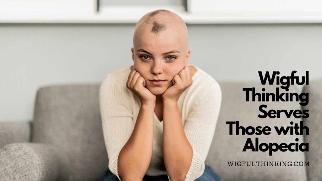 alopecia